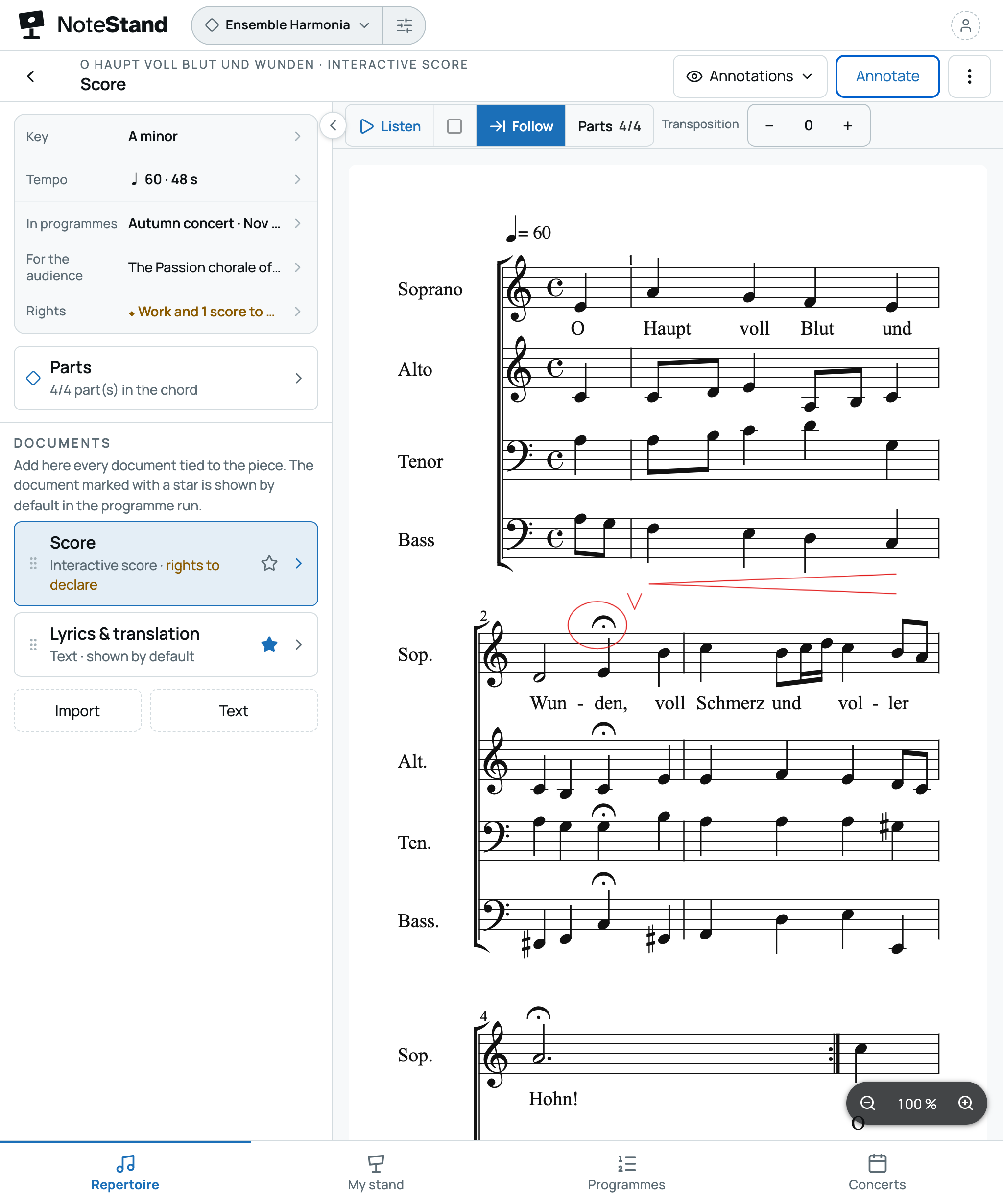 A piece sheet: four-part engraved score annotated with a stylus (fermata, breath, crescendo), parts and documents
